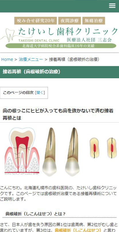 精度の高い歯根破折の治療を得意とする「たけいし歯科」