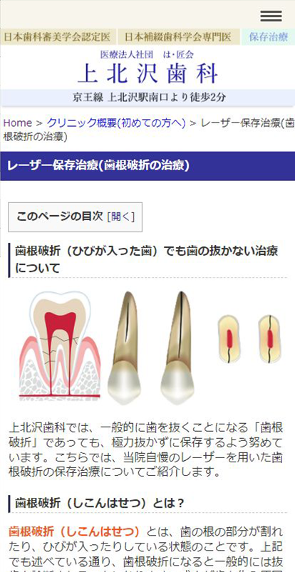 保存治療が得意！歯を抜きたくない人におすすめの「上北沢歯科」